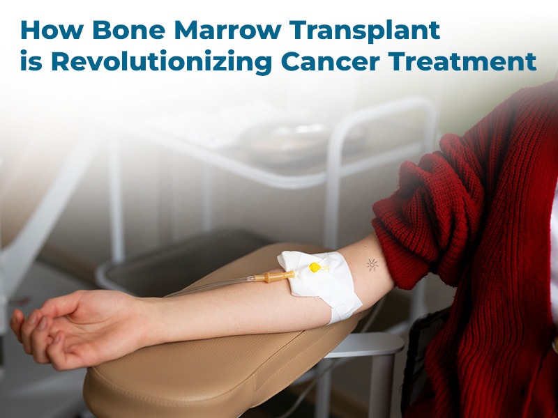 How Bone Marrow Transplant is Revolutionizing Cancer Treatment